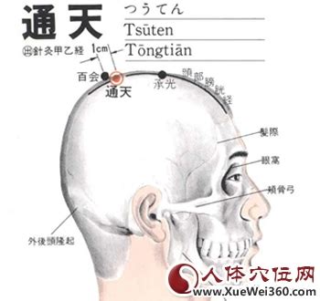 通天穴|通天穴的准确位置图和作用